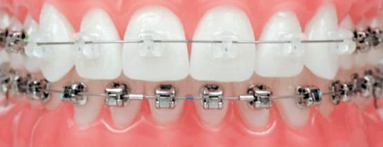 centro-dental-epadent-dientes