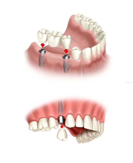 centro-dental-epadent-dienteswor